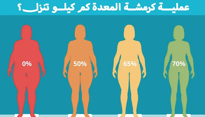 كرمشة المعدة كم كيلو تنزل؟