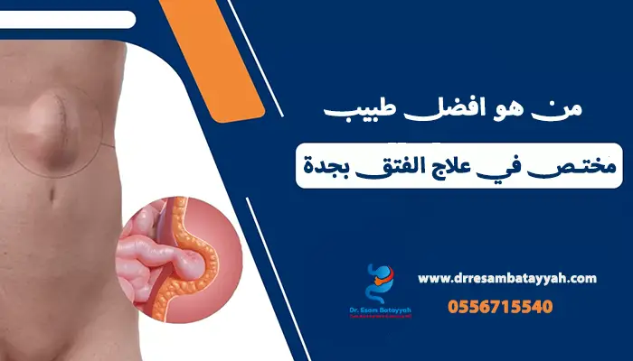 من هو افضل طبيب مختص في علاج الفتق بجدة؟