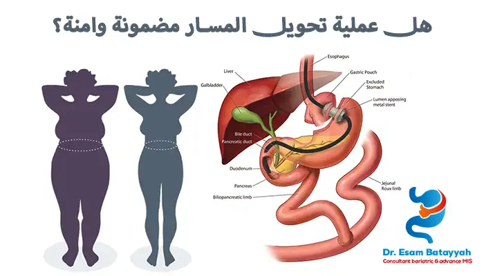 هل عملية تحويل المسار مضمونة وامنة؟