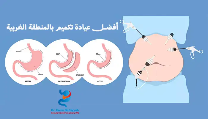 أفضل عيادة تكميم بالمنطقة الغربية