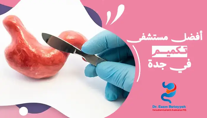 أفضل مستشفى تكميم في جدة