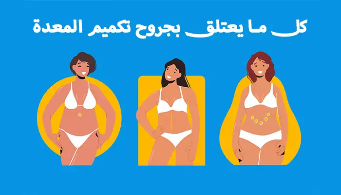 جروح تكميم المعدة: ماذا يمكن توقعه أثناء وبعد العملية