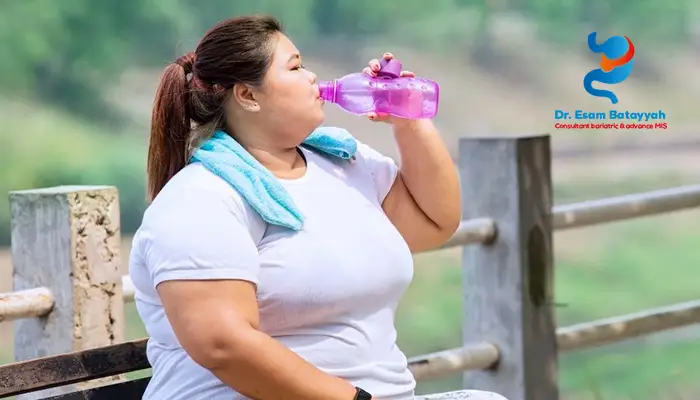 أضرار تكميم المعدة للنساء