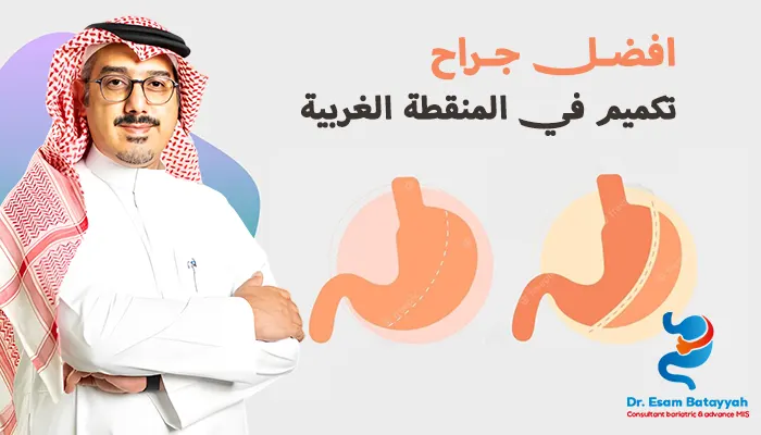 أفضل جراح تكميم في المنقطة الغربية