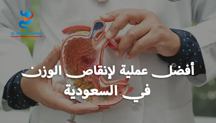 أفضل عملية لإنقاص الوزن في السعودية