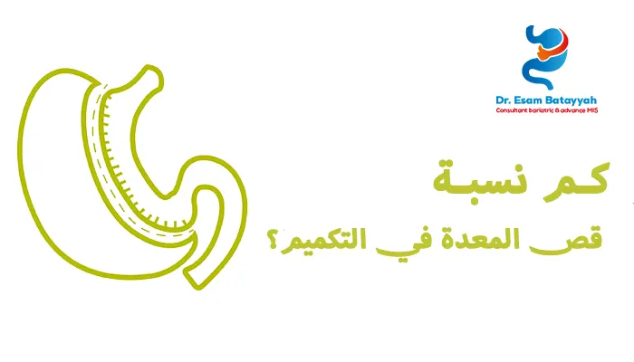 كم نسبة قص المعدة في التكميم؟