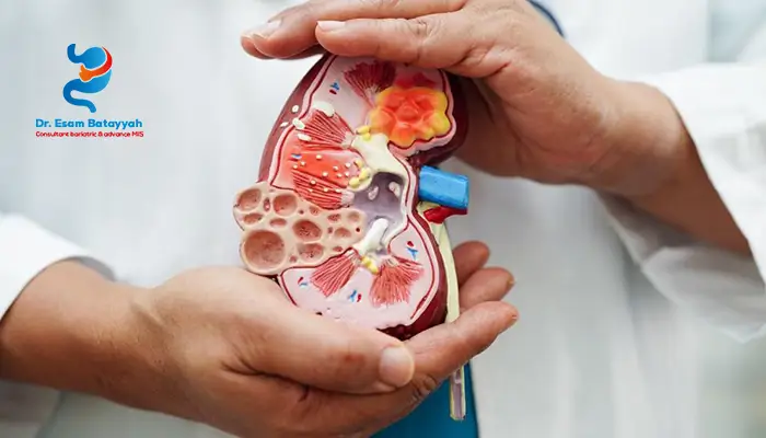 مخاطر الجراحة الروبوتية للسمنة