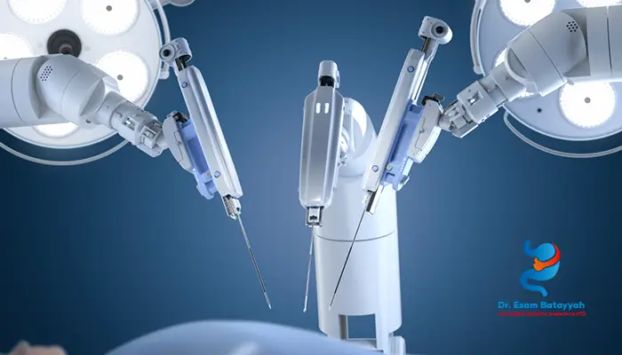 مزايا الجراحة الروبوتية