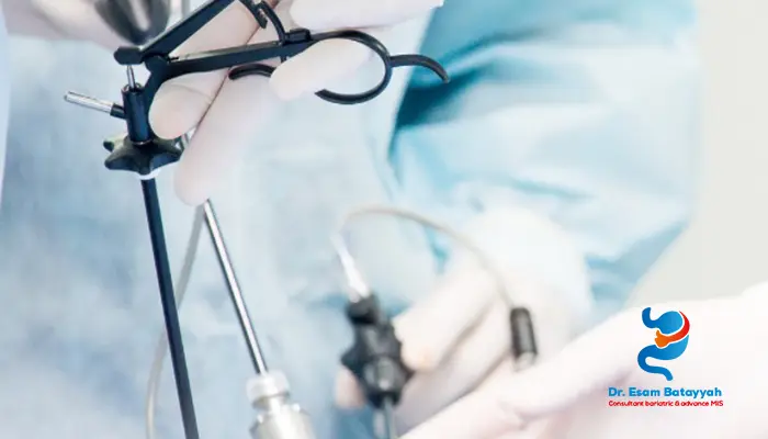 الفرق بين جراحة المناظير والجراحة الروبوتية