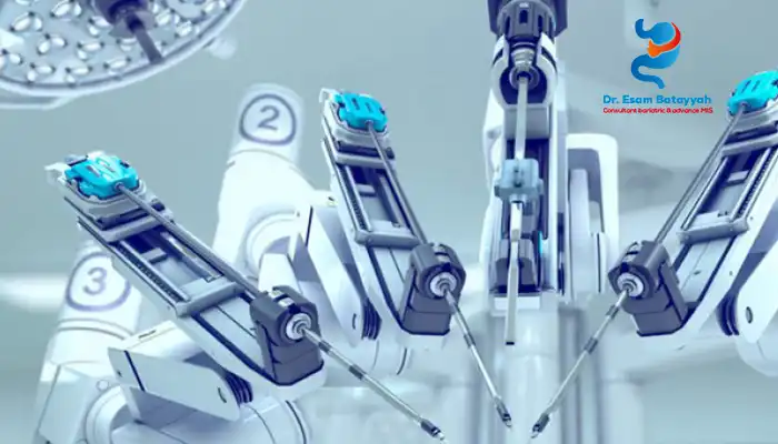 فوائد الروبوت الطبي لعلاج السمنة