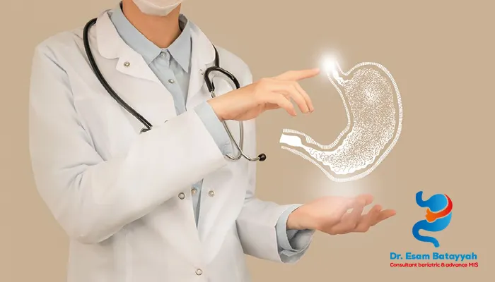 أفضل عيادة قص معدة بخبرة عالية في المنطقة الغربية