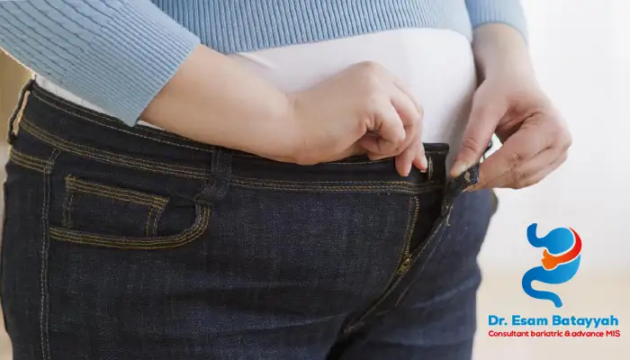 كم يستغرق التعافي بعد كرمشة المعدة؟