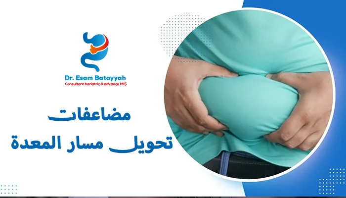 مضاعفات تحويل مسار المعدة