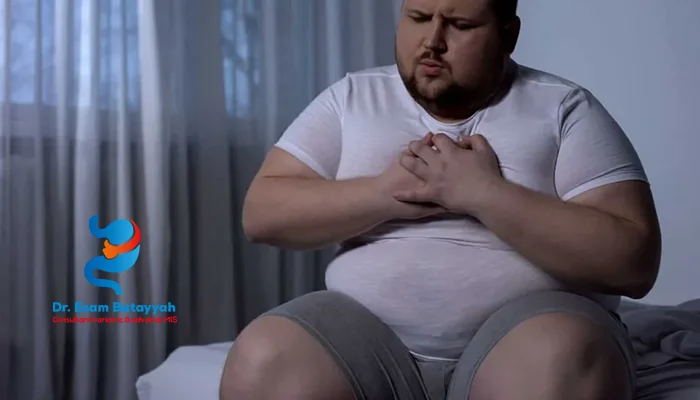 مضاعفات تكميم المعدة وكيف يتم علاجها