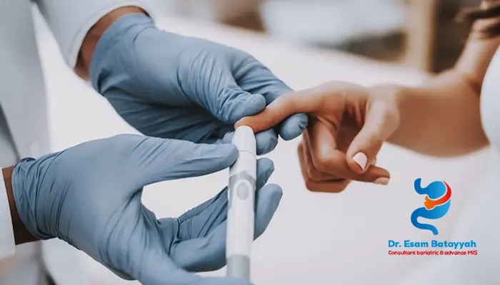 هل تحويل المسار يعالج السكر؟