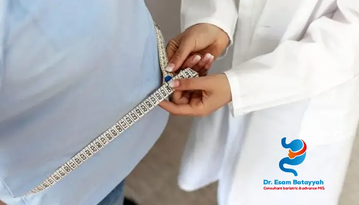 أقل وزن لعملية تكميم المعدة