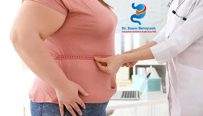 شروط عملية تكميم المعدة