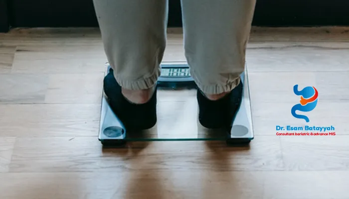 متى يُفضل تحويل المسار عن التكميم؟