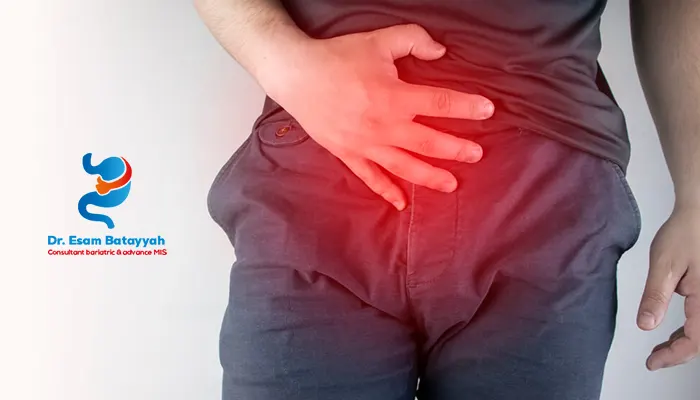 هل الفتق الإربي خطير؟