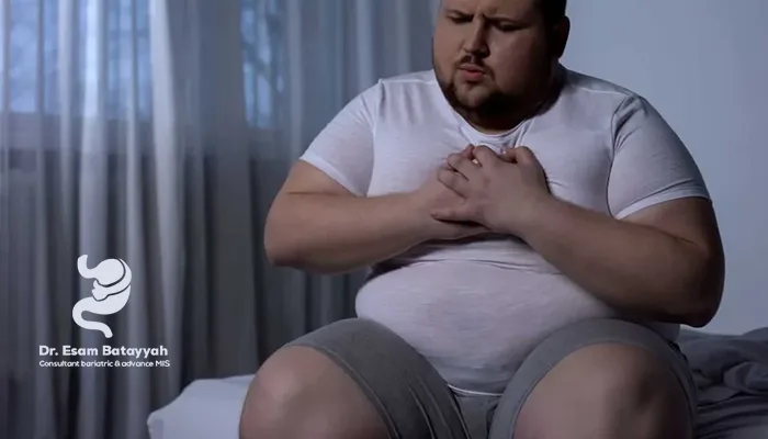 هل عملية تكميم المعدة تسبب الوفاة