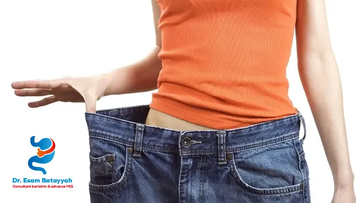 هل ندمت على عملية التكميم