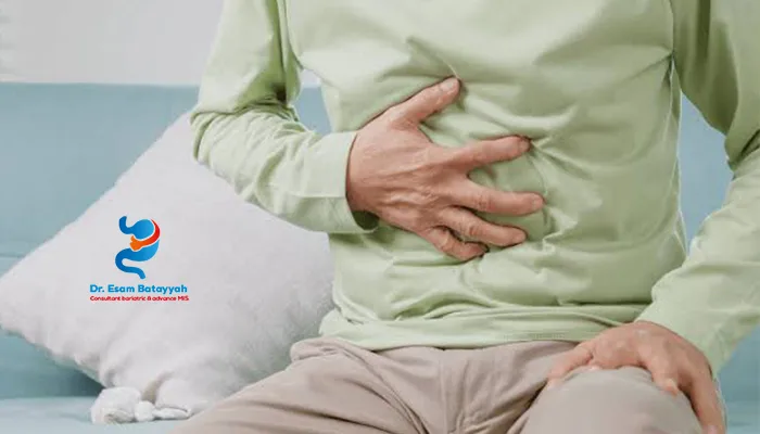 أفضل عيادة إصلاح الفتق المتكرر بجدة
