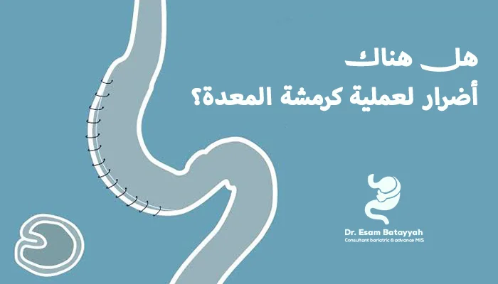 هل هناك أضرار لعملية كرمشة المعدة؟