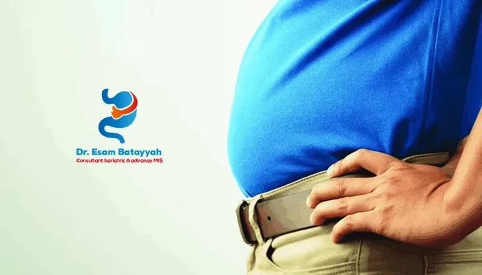 ماذا نفعل عندما يزيد الوزن بعد عملية تحويل المسار