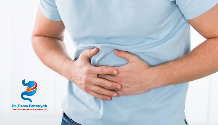 هل يمكن علاج فتق الحجاب الحاجز بدون جراحة؟