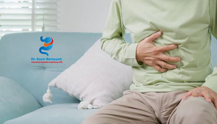 أعراض الفتق التي تستدعي زيارة الطبيب فورًا